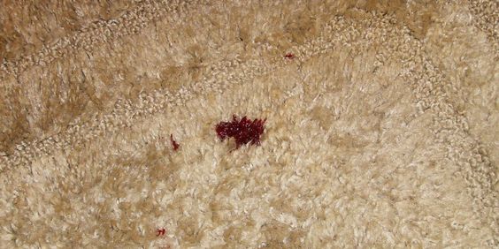 چگونه لکه خون را از فرش پاک کنیم؟