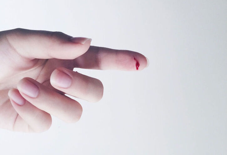 علت سوزش و درد با بریده شدن توسط کاغذ